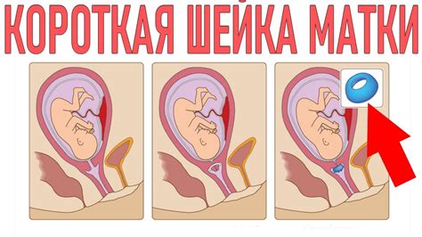 Гормональные изменения и связь с шейкой матки