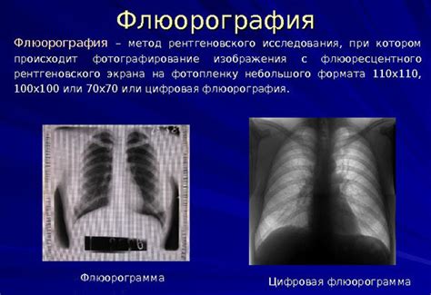 Двухпроекционная флюорография: суть и применение