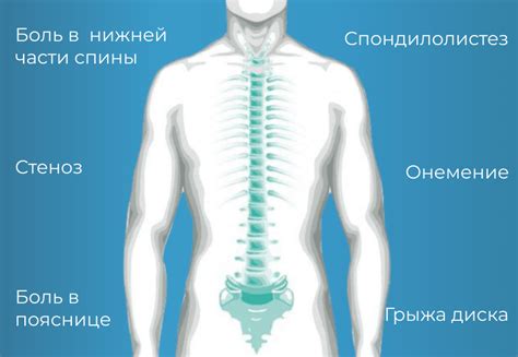 Дегенеративные заболевания позвоночника