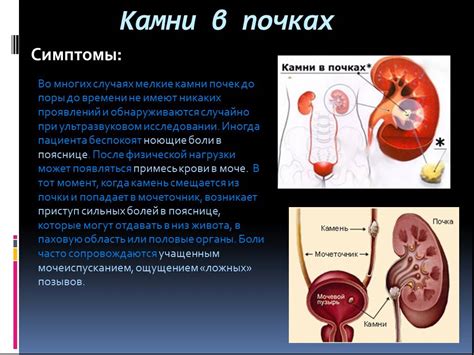 Дергание почки с правой стороны: возможные причины