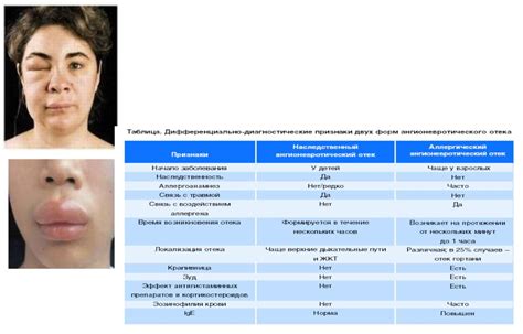 Дефекты системы выпуска: вред и решение проблемы