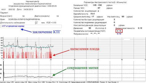 Диагностика: как определить акселерацию 0 на ктг