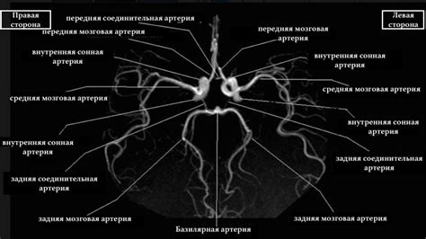 Диагностика Замкнутого Виллизиева круга