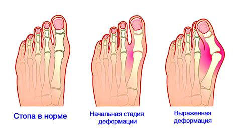 Диагностика боли в пальце на левой ноге