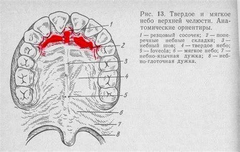 Диагностика воспаления верхнего нёба