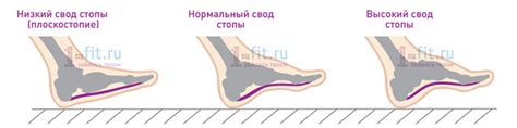 Диагностика высокого подъема ноги