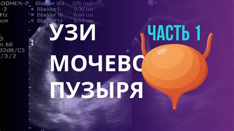 Диагностика диффузных изменений стенки мочевого пузыря