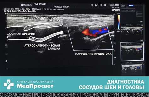 Диагностика дуплекс сосудов головы и шеи