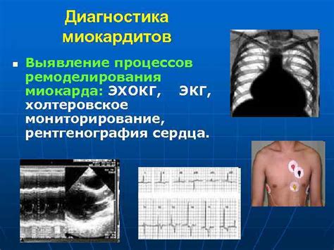 Диагностика и выявление нестабильности миокарда