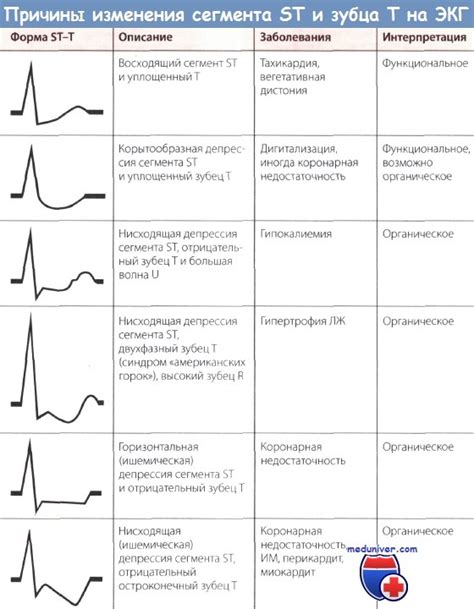 Диагностика и лечение субэпикардиальной ишемии миокарда