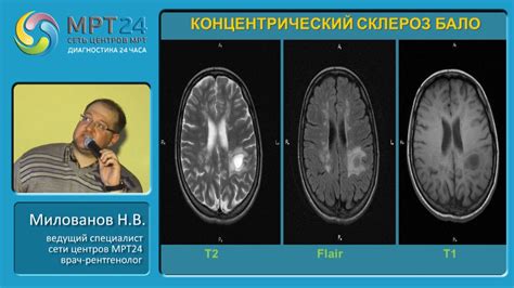 Диагностика катаральных изменений