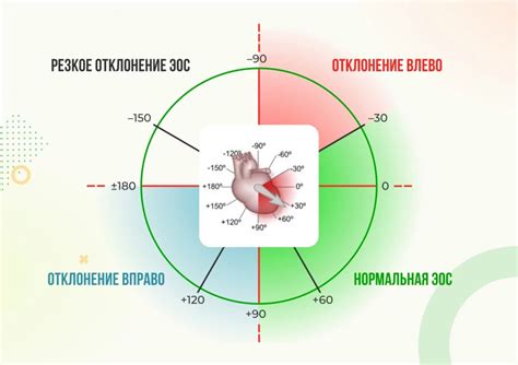 Диагностика отклонения ЭОС вправо