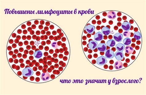 Диагностика повышенного количества лимфоцитов