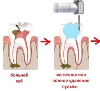 Диагностика свища на десне