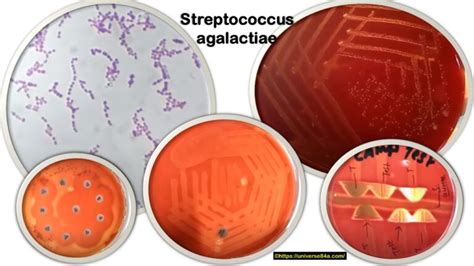 Диагностика Streptococcus agalactiae