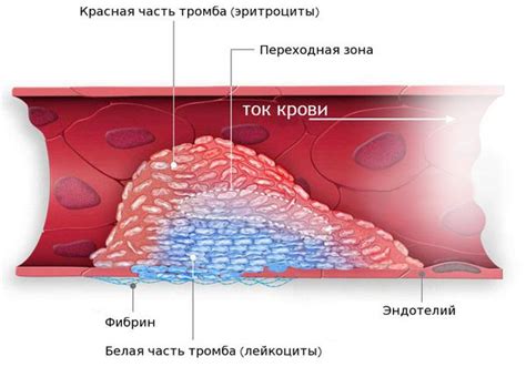 Диастолическая регургитация 1 степени