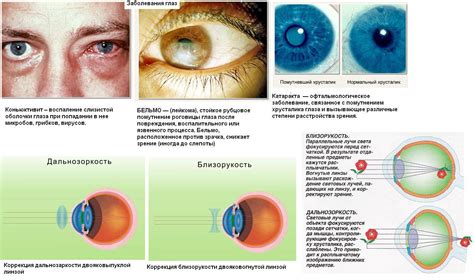 Заболевания глаз и организма
