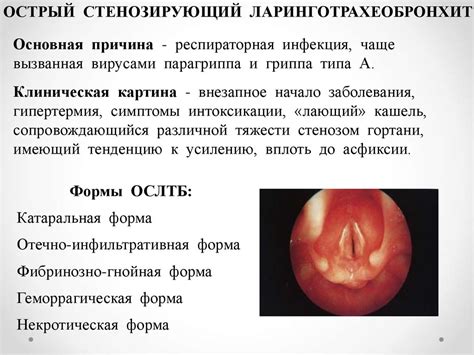 Заболевания гортани