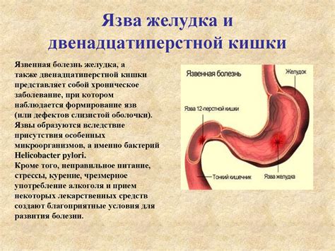 Заболевания желудка и пищеварительной системы