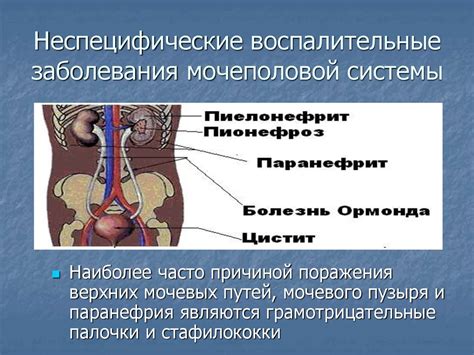 Заболевания мочеполовой системы