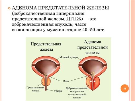 Заболевания мочеполовых органов