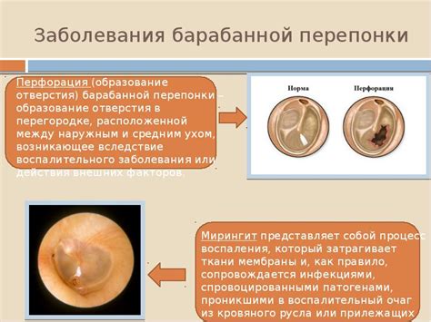 Заболевания среднего уха, приводящие к нарушению слуха