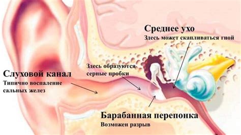 Заедание серым в ушном канале