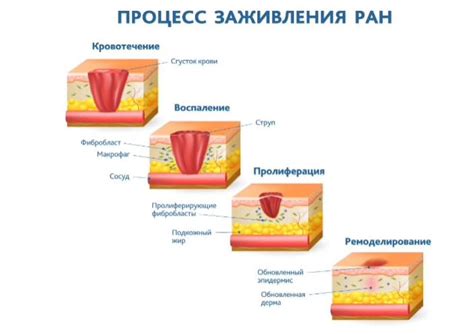 Замедленное заживление ран и ссадин: длительное время заживления повреждений кожи