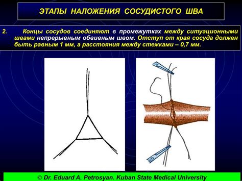 Значение промежутков в кровеносных сосудах