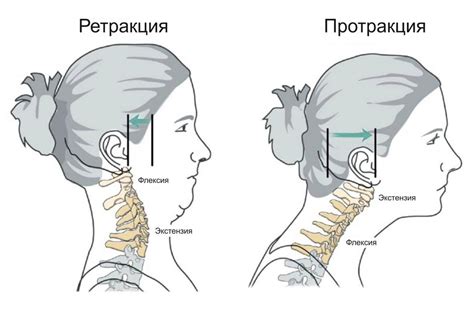 Избыточное нагружение шейного отдела