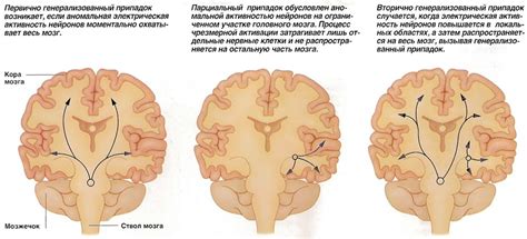 Изменения в мозге, вызывающие потерю сознания при сне