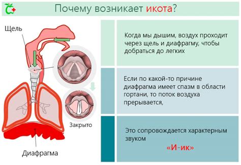 Икота и медицинские методы лечения