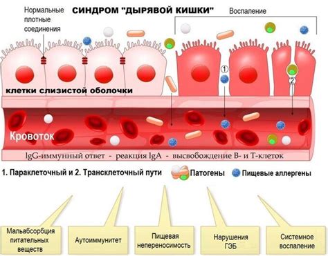 Инфекции кишечника и желудка, вызывающие жжение в кишках