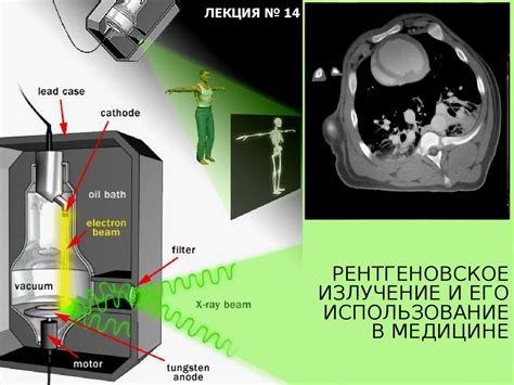 Использование коллиматоров в медицине