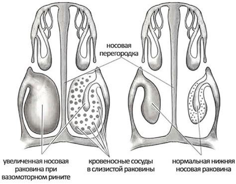 Источники натуральной влаги