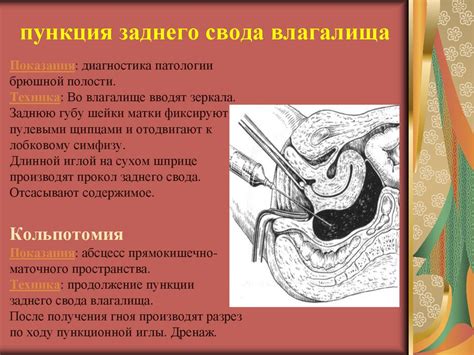 Источник проблемы в органах малого таза