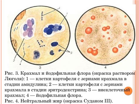 Йодофильная флора в кале: значение и особенности