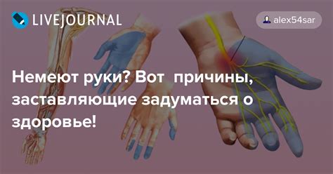 Какие другие заболевания могут привести к онемению пальцев левой руки?