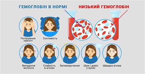 Какие признаки говорят о низком уровне гемоглобина?