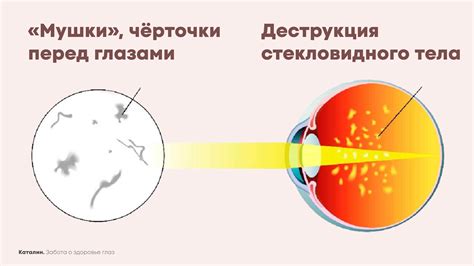 Какие причины могут вызывать черные мушки перед глазами?