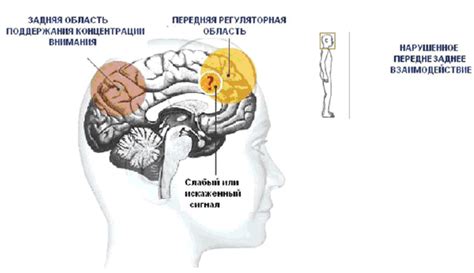 Какие симптомы сопровождают синдром дефицита внимания