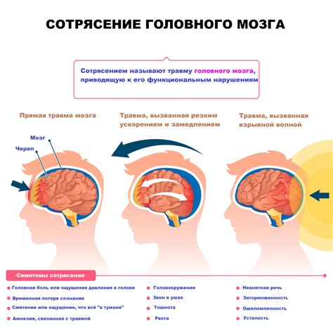 Какие симптомы сопровождают сотрясение мозга?