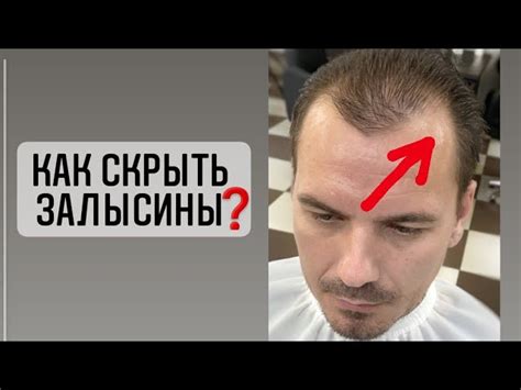 Каким способом можно решить проблему выпадения волос?