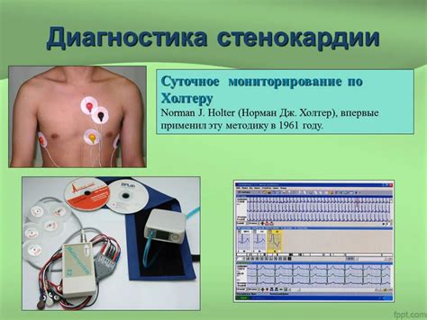 Какова цель суточного мониторирования экг по холтеру?