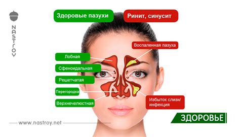 Как бороться с сухостью в носу и горле