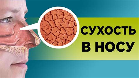 Как влияет обувь на сухость носа и горла