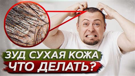 Как избавиться от зуда?