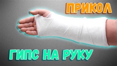 Как избежать давления гипса на руке в будущем?