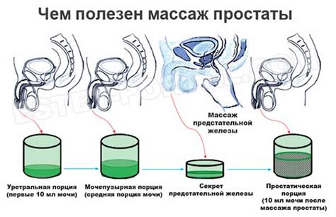 Как массировать простату самостоятельно