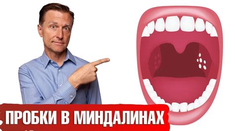 Как можно предотвратить появление белых точек на гландах?